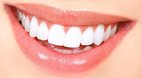 Dentes-claros-768x427