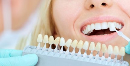 Qual é a diferença entre Faceta de Porcelana e Lente de Contato Dental?