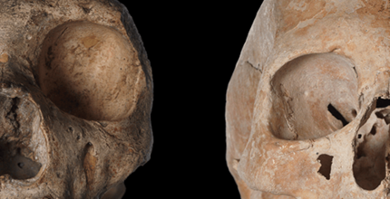 A odontologia dos Neanderthais